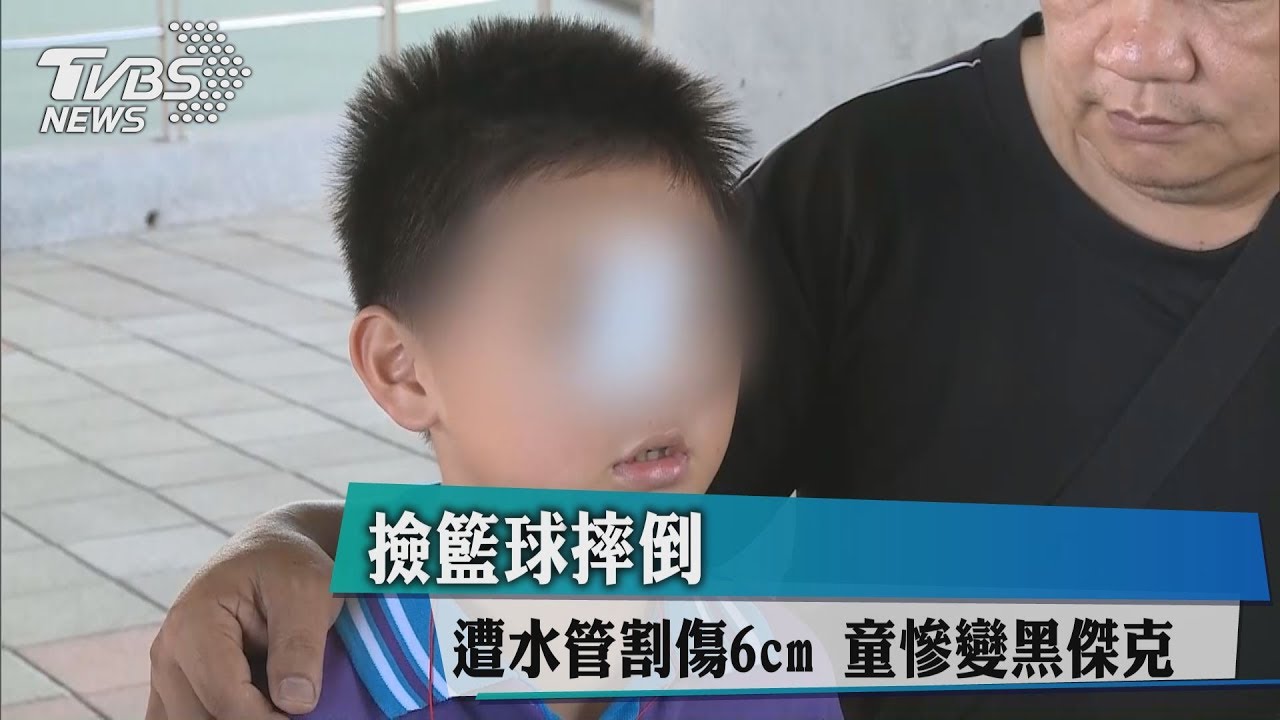 撿籃球摔倒!遭水管割傷6cm 童慘變黑傑克