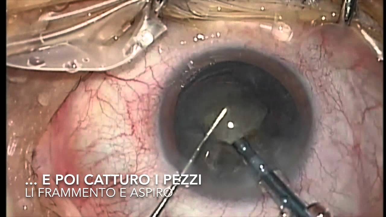 Alessandro Sammartino-3