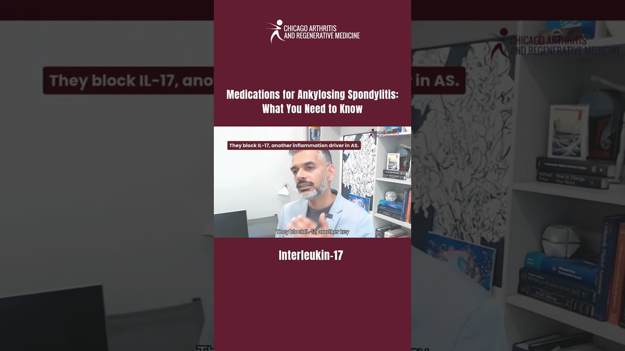 Interleukin-17 Medications for Ankylosing Spondylitis: What you need to know #AnkylosingSpondylitis