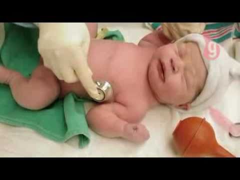 Cuidados com o recém-nascido na sala de parto >