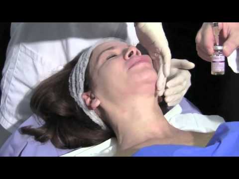 I denti di leone da pigmentary notano la ricetta Pigmentazione di malattie della pelle di faccia