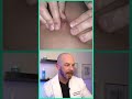 Derm reacts to SHOOTING abscess! #dermreacts #doctorreacts #abcess #pimplepop