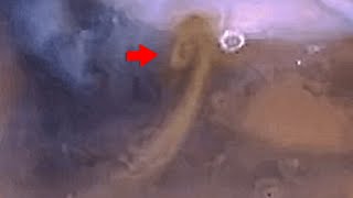 Huge Vortex of Dust Storm on Mars and its impact on on Martian climate