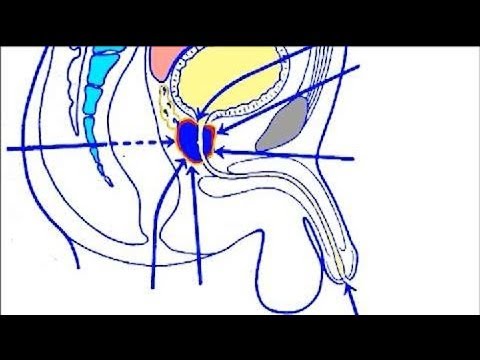 Was ist die normale Größe der Prostata Entzündung in der Prostata