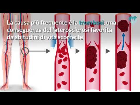 Un vantaggio in un pene piccolo Come mantenere la potenza fino a tardi