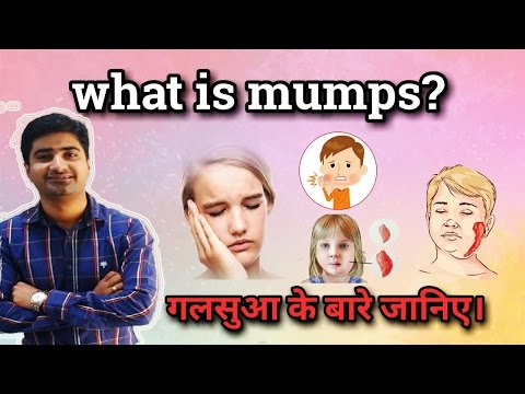 MUMPS | CAUSES | SYMPTOMS | TREATMENT | HINDI Video