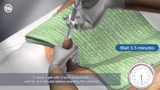 Male catheterisation Animation Video