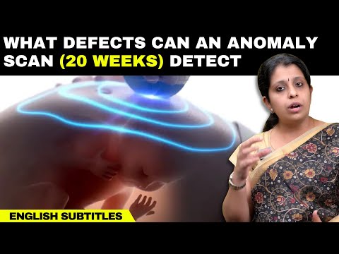 What defects can an anomaly scan (20weeks) detect | கருவின் குறைபாடுகளை அறிய உதவும் அனாமலி ஸ்கேன்!