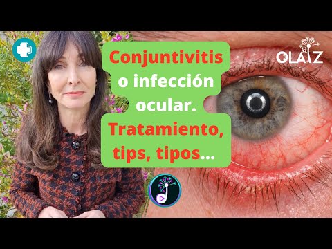 Tratamiento de la conjuntivitis. Tips, tipos....