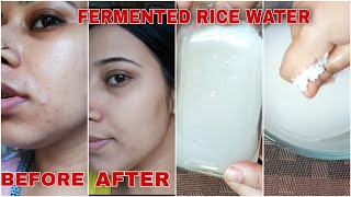 DIY Fermented Rice Water Toner For Clear, Spotless, Glowing & Brighter Skin