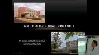 preview picture of video 'Astrágalo Vertical Congénito'