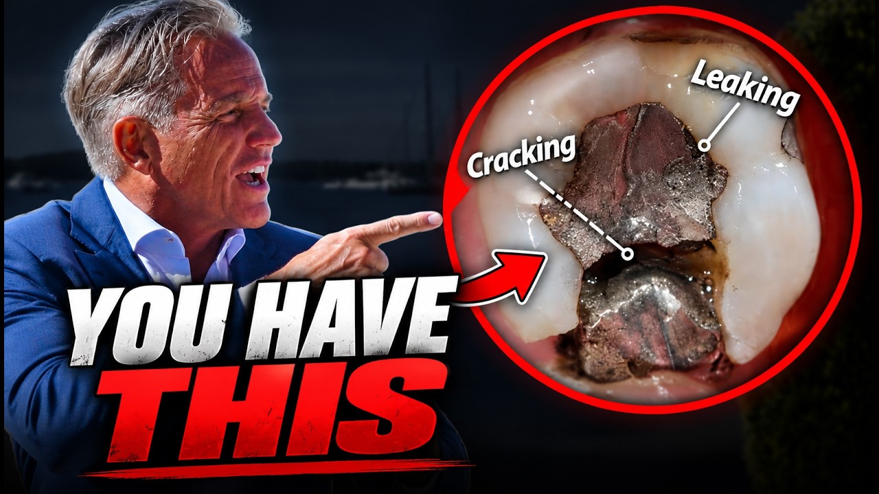 Exposing the Truth About Mercury Fillings (And What Your Dentist Won’t Tell You)