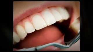 preview picture of video 'RB Family Dentistry Rancho Bernardo - Call 858.485.5925'