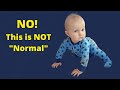 Baby Crawling With One Leg - No, this is not normal:  Atypical Crawling - One-Legged Crawling