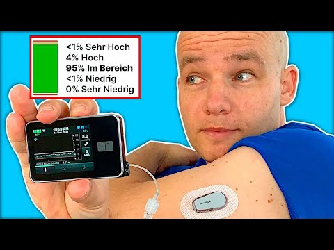 Wie der Tandem t:slim X2 & Control IQ mein Leben verändert haben – Insulinpumpen-Review