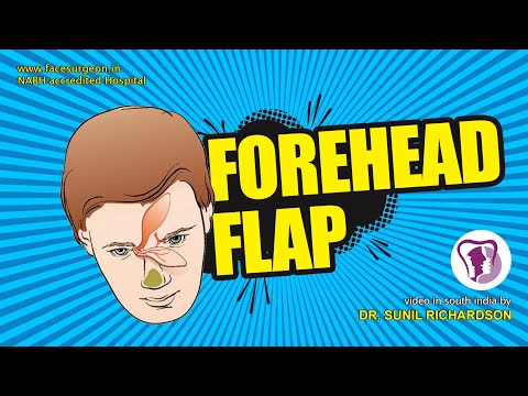 Forehead Flap Begin Divided