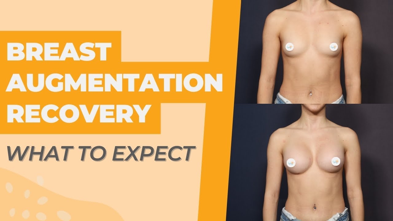 Breast Augmentation Recovery: Plastic Surgeon Explains What To Expect
