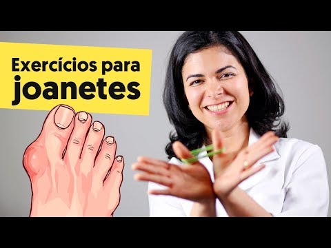 Imagem ilustrativa do vídeo: EXERCÍCIOS PARA JOANETE (e COMO NUNCA TER!)