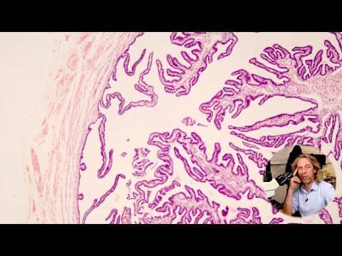 Histology of the Fallopian tube