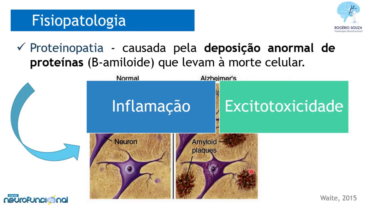 DOENÇA DE ALZHEIMER - Aula Completa - Rogério Souza