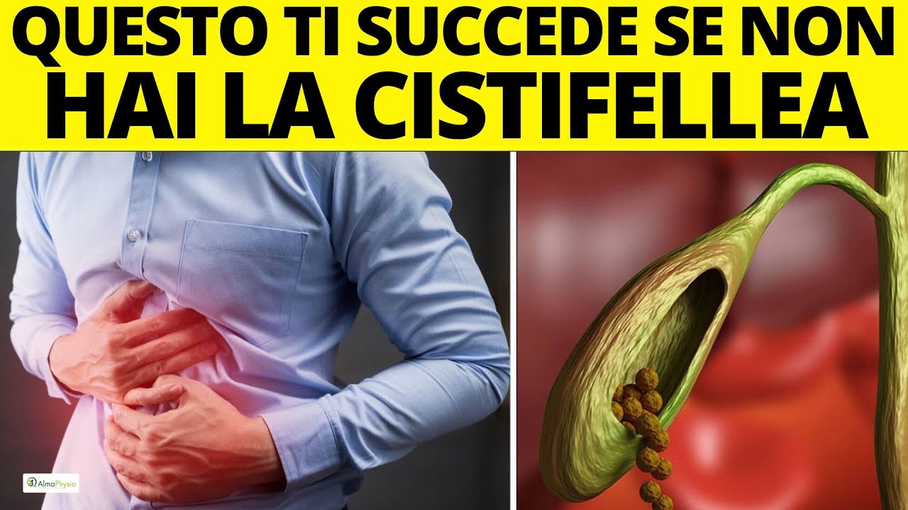 Come CAMBIA il tuo CORPO quando NON hai la CISTIFELLEA (colecistectomia)