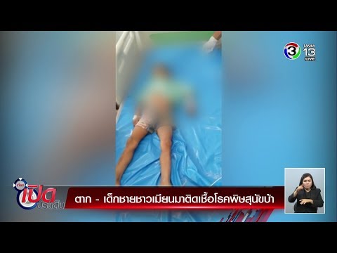 ที่จาก pornoaktera อวัยวะเพศชาย เพิ่มสมาชิกครีม