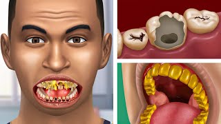 ASMR Tooth Decay Treatment & Oral Hygiene | Dentist Animation