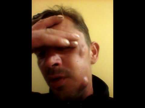 Krem na powiększenie penisa w aptekach Oznacza na forum powiększanie penisa