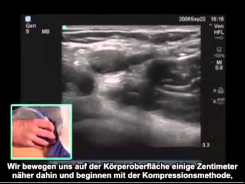 Prostata-Stress Gefühle der Menschen von Prostata-Massage