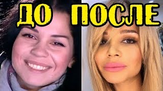 СКОЛЬКО СТОЯТ ПЛАСТИЧЕСКИЕ ОПЕРАЦИИ УЧАСТНИЦ ДОМ2?