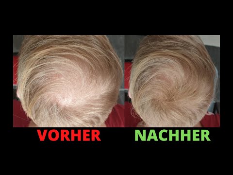 Streuhaar Anwendung Tonsur