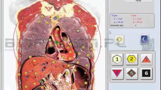 BIOPLASM NLS DEMO VIDEO 1