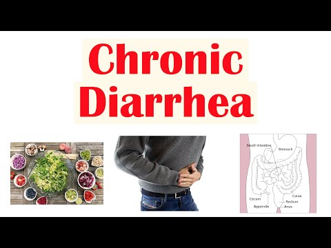 Chronic Diarrhea: Approach to Cause, Secretory vs Osmotic vs Inflammatory, Watery vs Bloody Diarrhea