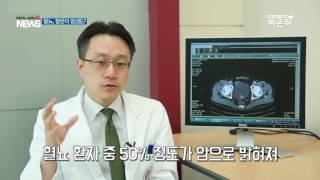 [기획취재]혈뇨 절반이 암 진단 - 연구결과