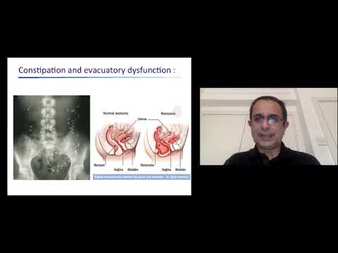 Virtual Summer Conference 2020: Managing GI Complications - Professor Qasim Aziz