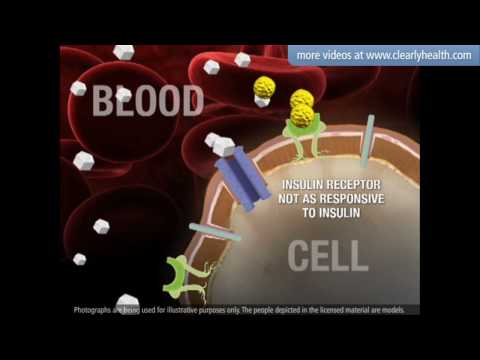 Diabetes: sulfonylureas medication