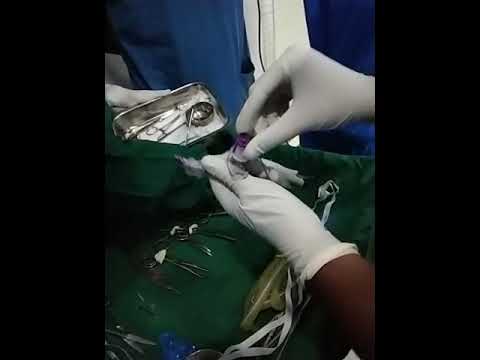 How to arrange tracheostomy tube?