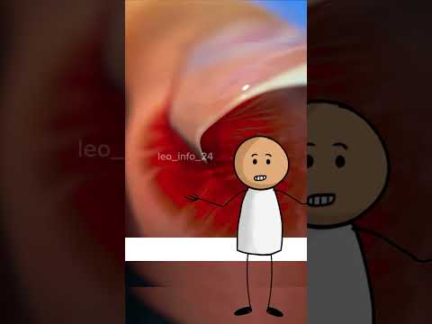 Su teclado se deformó de forma algo peligrosa y la razón no fue por un golpe o caída