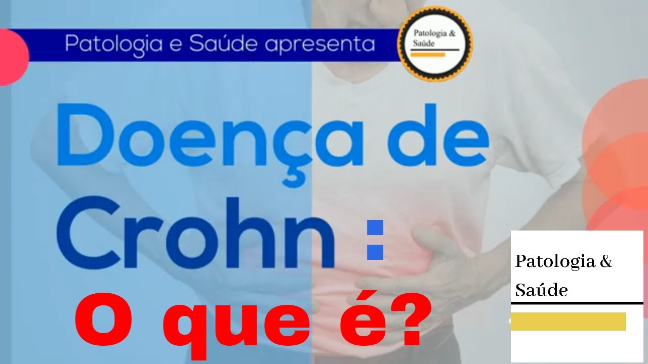 Você sabe o que é a Doença de Crohn?