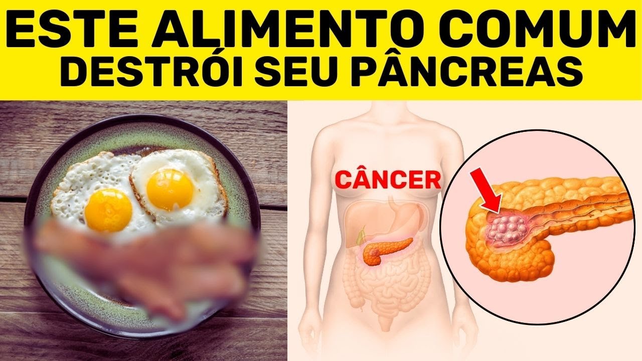AVISO! ESTE ALIMENTO COMUM DANIFICA SEU PÂNCREAS MAIS DO QUE O ÁLCOOL, E NINGUÉM ESTÁ LHE DIZENDO