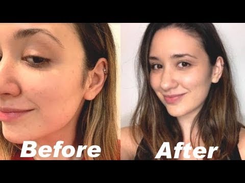 download lagu mp3 mp4 Best Collagen Capsules For Skin In India, download lagu Best Collagen Capsules For Skin In India gratis, unduh video klip Best Collagen Capsules For Skin In India
