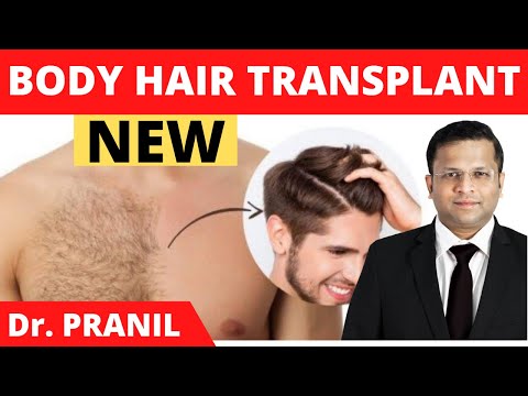 Body Hair Transplant (BHT) Fully Explained || Chest...