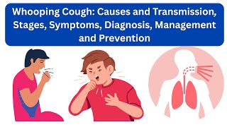 Download Lagu Whooping Cough: Causes and Transmission, Stages, Symptoms, Diagnosis, Management and Prevention Thumbnail
