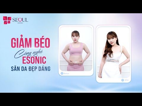 Hiệu Quả Liệu Trình Giảm Béo Esonic Sau 2 Lần Thực Hiện