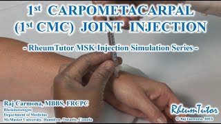 1st CARPOMETACARPAL (CMC) JOINT INJECTION: Step-By-Step Instructions