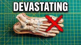 Turf Toe Explained – Why It's SO Bad