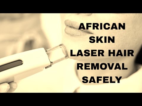 laser hair removal african skin | afro carrebean skin laser I laser hair removal dark skin