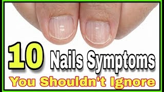 10 Nail Symptoms and What They Mean for Your Health You Shouldn&#39;t Ignore