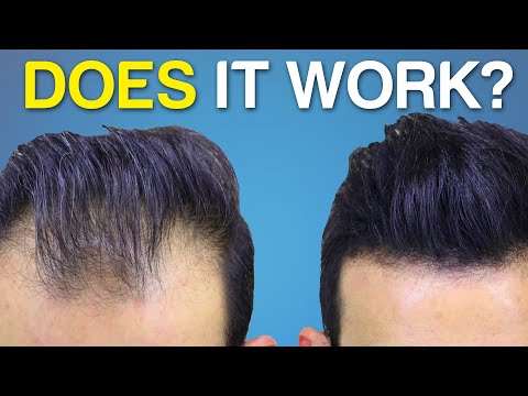 Does Hair Fiber SPRAY Work? BETTER Hair Coverage?