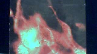 cemetary - so sad your sorrow